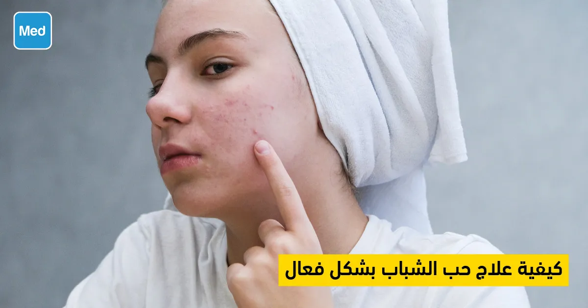 كيفية علاج حب الشباب بشكل فعال